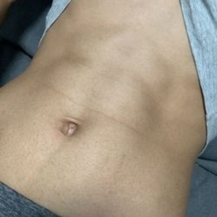 u91047725